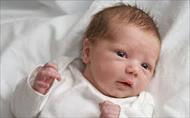پاورپوینت هایپوتیروئیدی در نوزادان